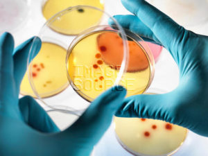 Scientist examining petri dishes in lab